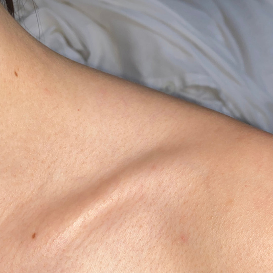 After image for the frank body Acid Heroes Kit: smooth, even skin across the neck and collarbone.
