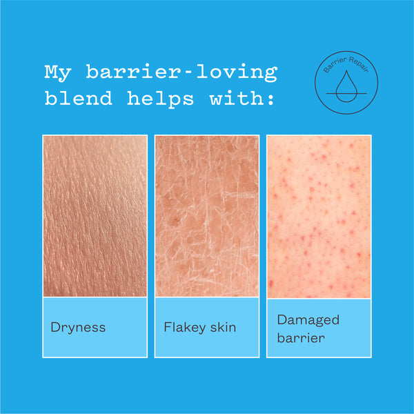 Close-ups of dryness, flaky skin and a damaged barrier. Text reads: My barrier-loving blend helps with dryness, flakey skin, damaged barrier.