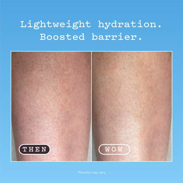 Hyaluronic Acid Body Serum before and after. Left panel labelled THEN is the before: dry, textured skin on the thighs. Right panel labelled WOW is the after: the same thighs looking hydrated and smooth. Text reads: Lightweight hydration. Boosted barrier. Results may vary.