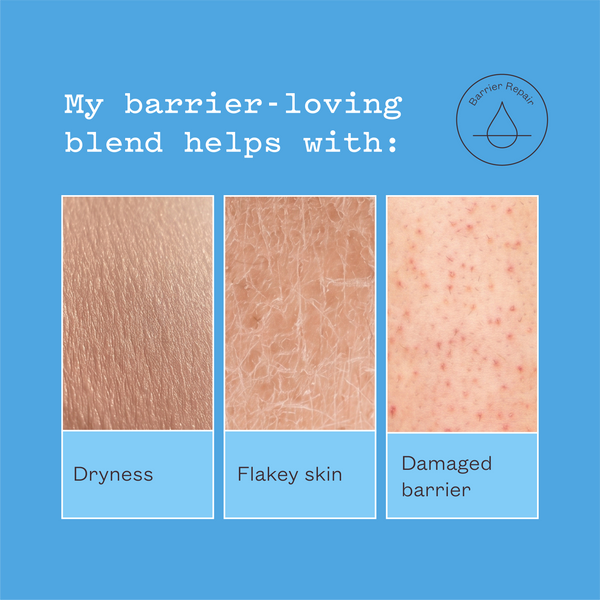 Close-ups of dryness, flaky skin and a damaged barrier. Text reads: My barrier-loving blend helps with dryness, flakey skin, damaged barrier.