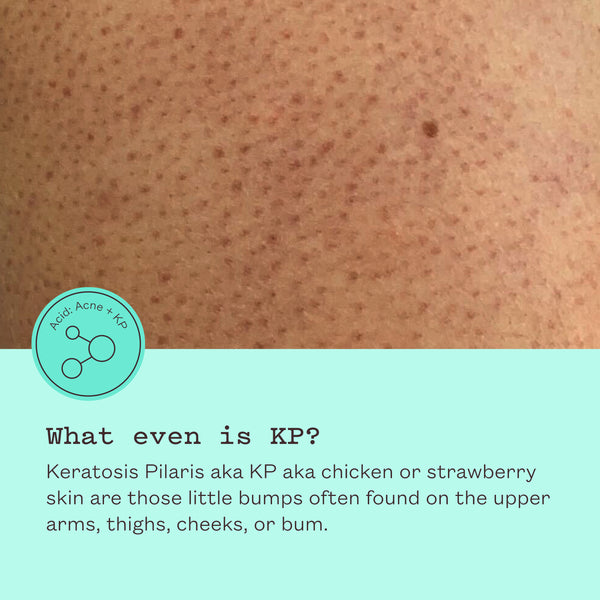 Smoothing AHA Body Lotion