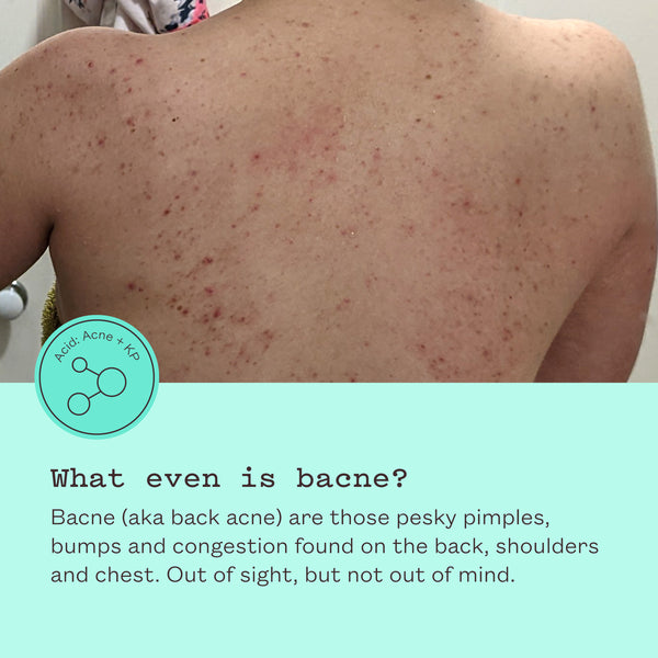 Triple Acid Body Mist