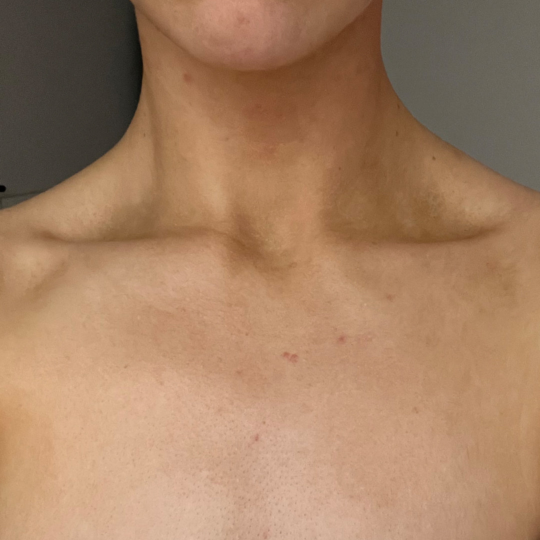 After image for frank body Niacinamide Body Scrub: clearer skin across the neck and chest.