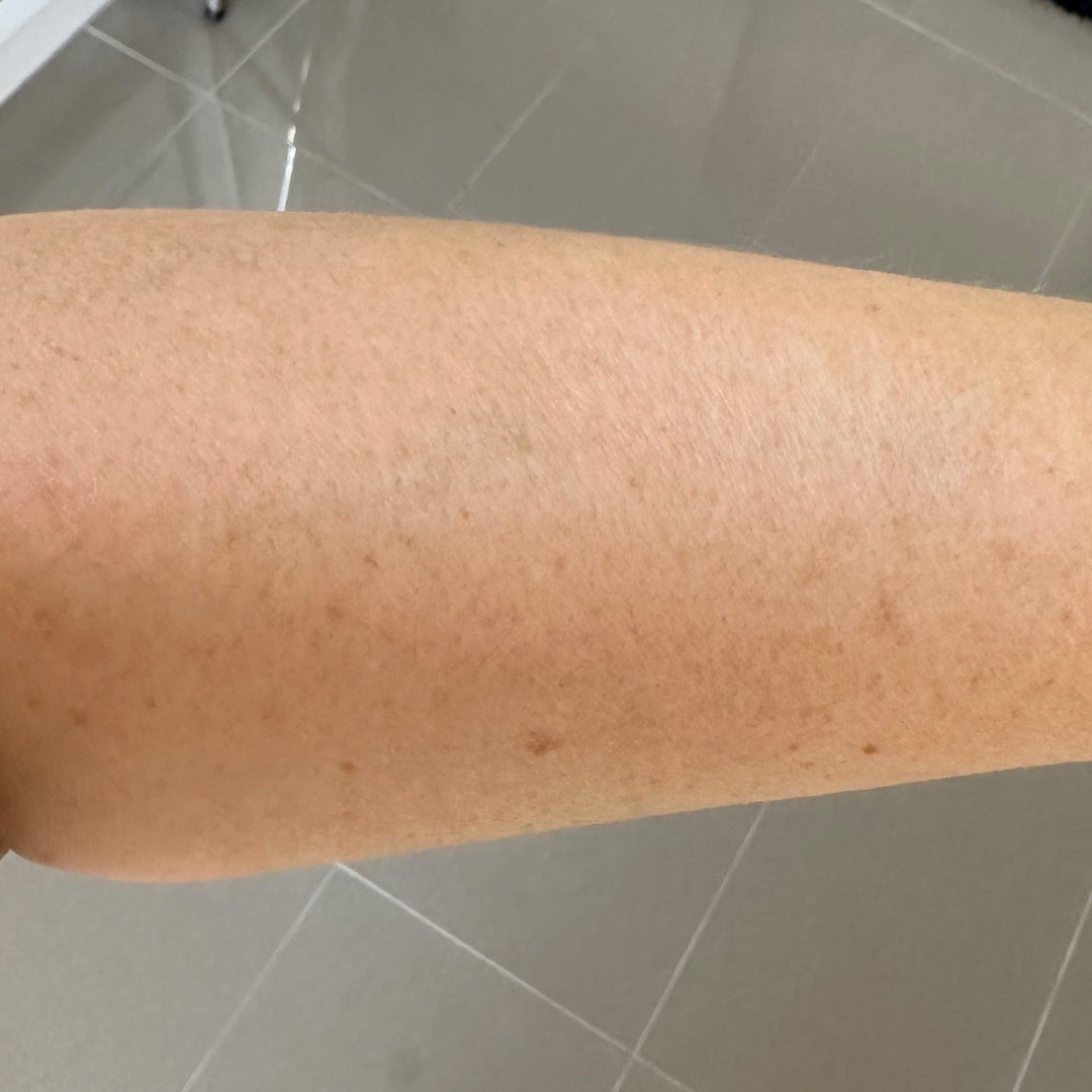 After image for frank body Niacinamide Correcting Body Lotion: smoother, more even skin along the lower leg.